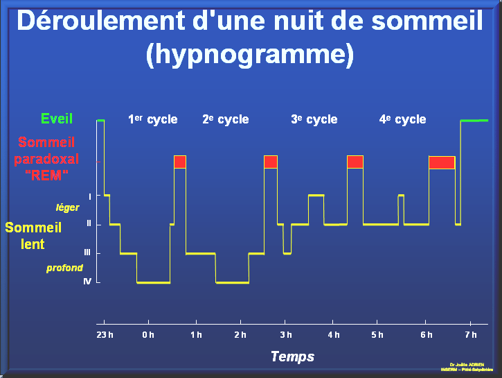 hypnogramme